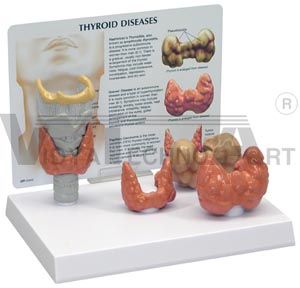 Thyroid